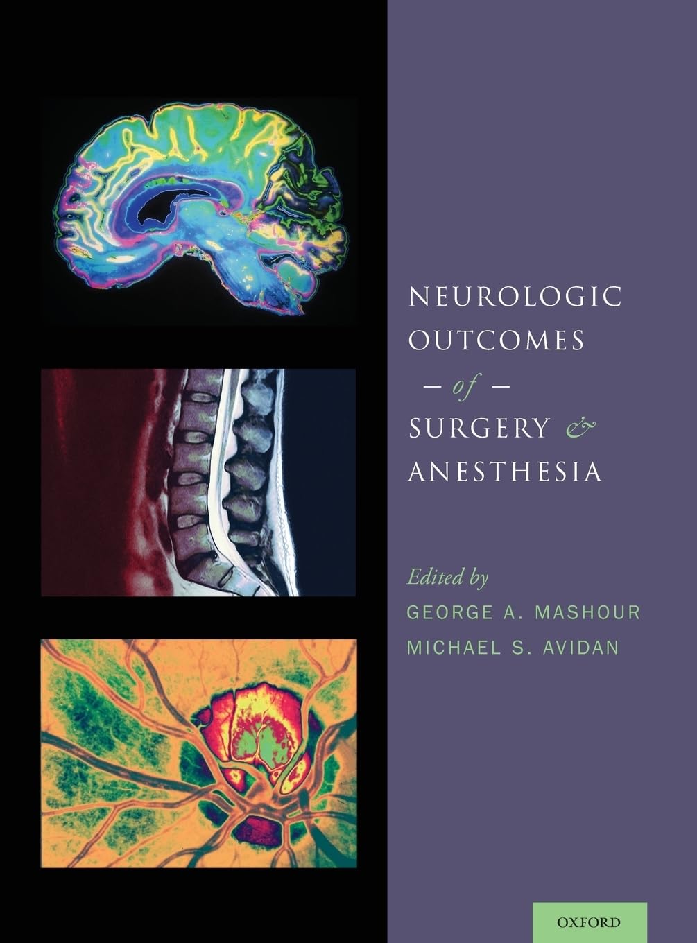 Neurologic Outcomes of Surgery and Anesthesia - Retail Maharaj
