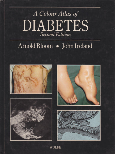 A Colour Atlas of Diabetes - Retail Maharaj