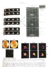 In 1v (Heart Disease: A Textbook of Cardiovascular Medicine) - Retail Maharaj