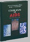 Color Atlas of AIDS - Retail Maharaj