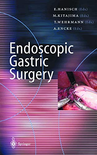Endoscopic Gastric Surgery - Retail Maharaj