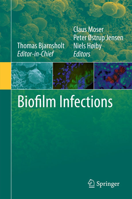 Biofilm Infections - Retail Maharaj