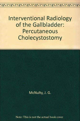 Interventional Radiology of the Gallbladder: Percutaneous Cholecystostomy - Retail Maharaj