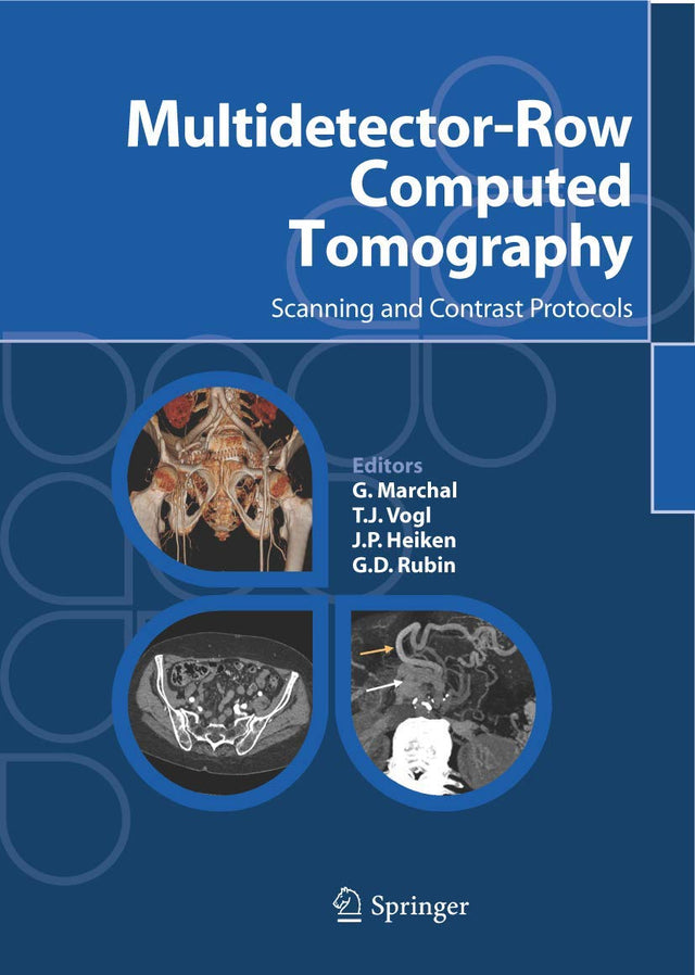 Multidetector-Row Computed Tomography: Scanning and Contrast Protocols - Retail Maharaj