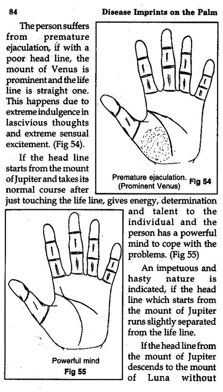 Disease Imprints on The Palm (Medical Palmistry) - Retail Maharaj