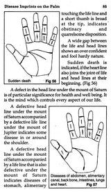Disease Imprints on The Palm (Medical Palmistry) - Retail Maharaj