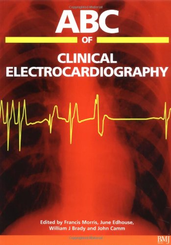 ABC of Clinical Electrocardiography (ABC Series) - Retail Maharaj