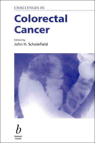 Challenges in Colorectal Cancer - Retail Maharaj