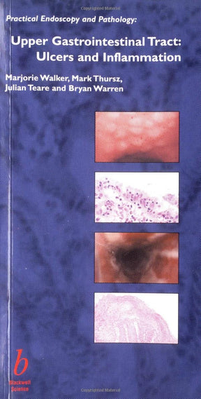Upper Gastrointestinal Tract: Ulcers and Inflammation (Practical Endoscopy and Pathology) - Retail Maharaj