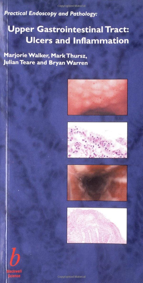 Upper Gastrointestinal Tract: Ulcers and Inflammation (Practical Endoscopy and Pathology) - Retail Maharaj